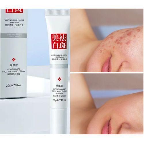 Sunburn, Dark Spots & Freckles Removal Cream Item | Buy Sunburn, Dark Spots & Freckles Removal Cream | SPOP Enterprise Global